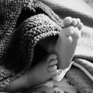 A black and white image of a baby's feet. The toes show the key characteristic of FOP